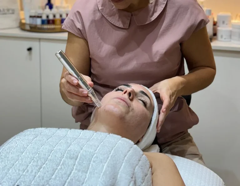 Dermapen Microneedling