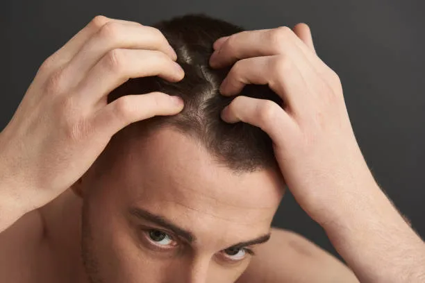 Plan Capilar Sara Molina